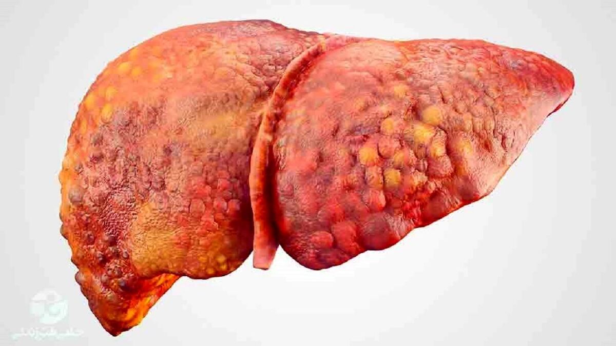 علائمی که نشان از مرگ زودهنگام می‌دهند