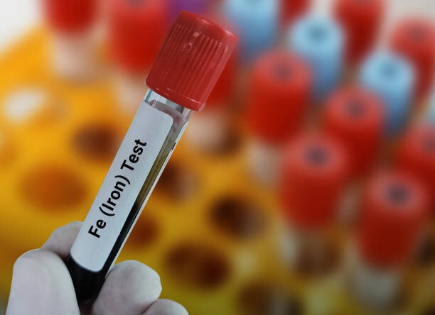 کمبود آهن عاملی برای ابتلا به کووید طولانی