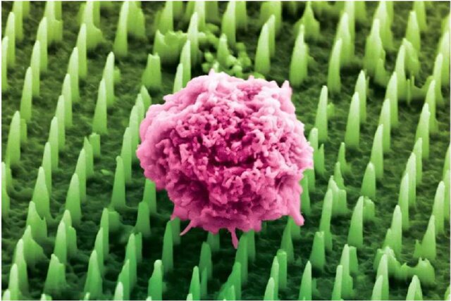 نمونه‌برداری از بافت بدون سوزن و درد ممکن شد