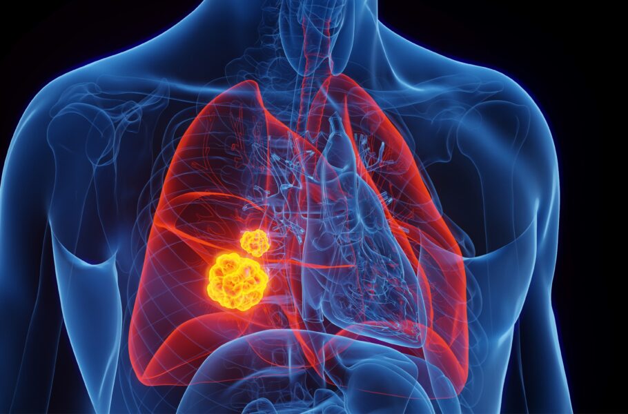 محققان روی راهکاری انقلابی کار می‌کنند: دستکاری سلول‌های سرطانی برای حمله به تومورها