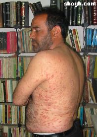 آیا براستی در این کشور و استان کسی نیست که برای یک جانباز شغل ایجاد نماید ؟؟؟!!!!آقای شاهدی جانبازی با 50 ماه سابقه حضور در جبهه !!!!!!!!!!!!! آیا براستی در این کشور و استان کسی نیست که برای یک جانباز شغل ایجاد نماید ؟؟؟!!!!آقای شاهدی جانبازی با 50 ماه سابقه حضور در جبهه !!!!!!!!!!!!!