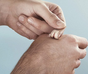 طب سنتی درباره درمان زخم ها چه پیشنهاداتی دارد؟