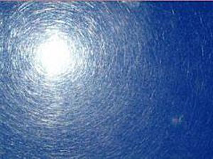 آفتاب سوختگی 