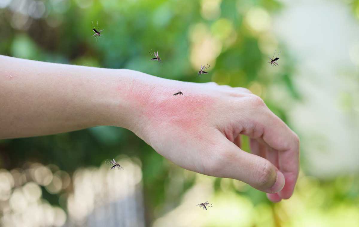 بهترین ترفند‌ها برای تسکین جای گزش پشه!