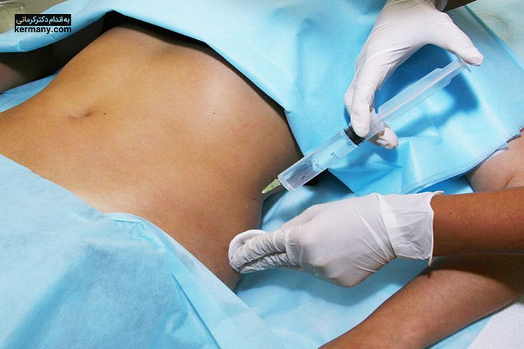 بوتاکس معده چه خطراتی برای سلامتی دارد؟